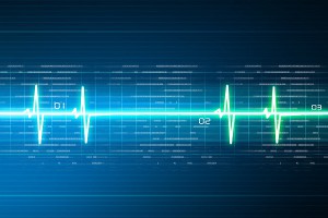 Electrocardiogram